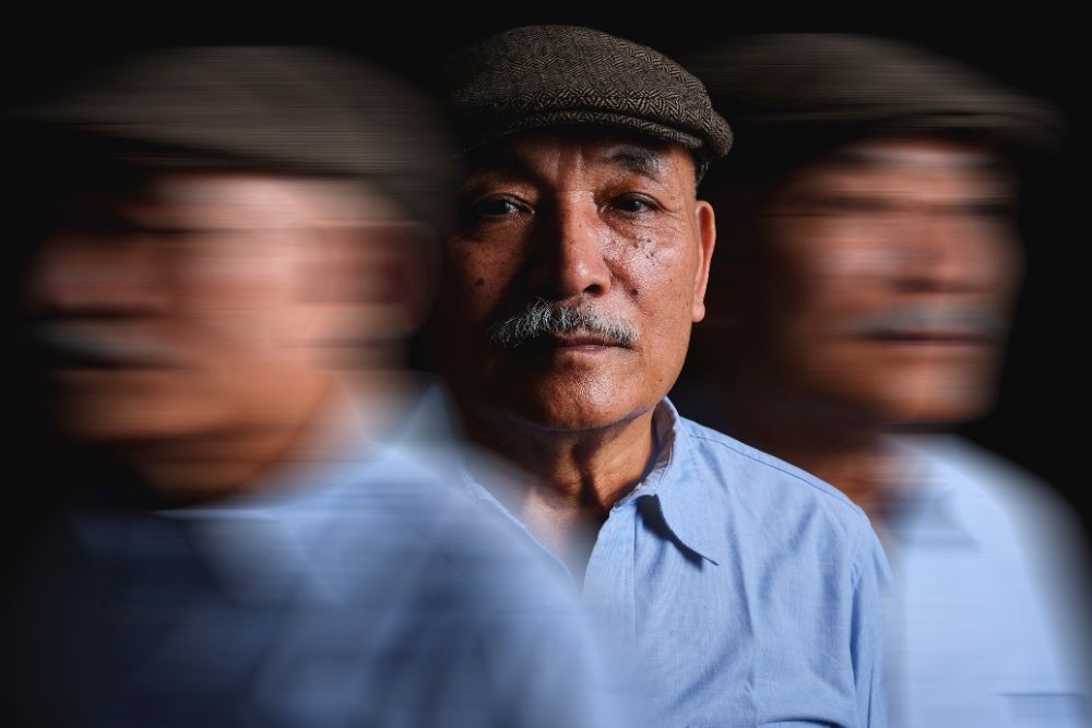 an elderly man suffering from Alzheimer’s disease